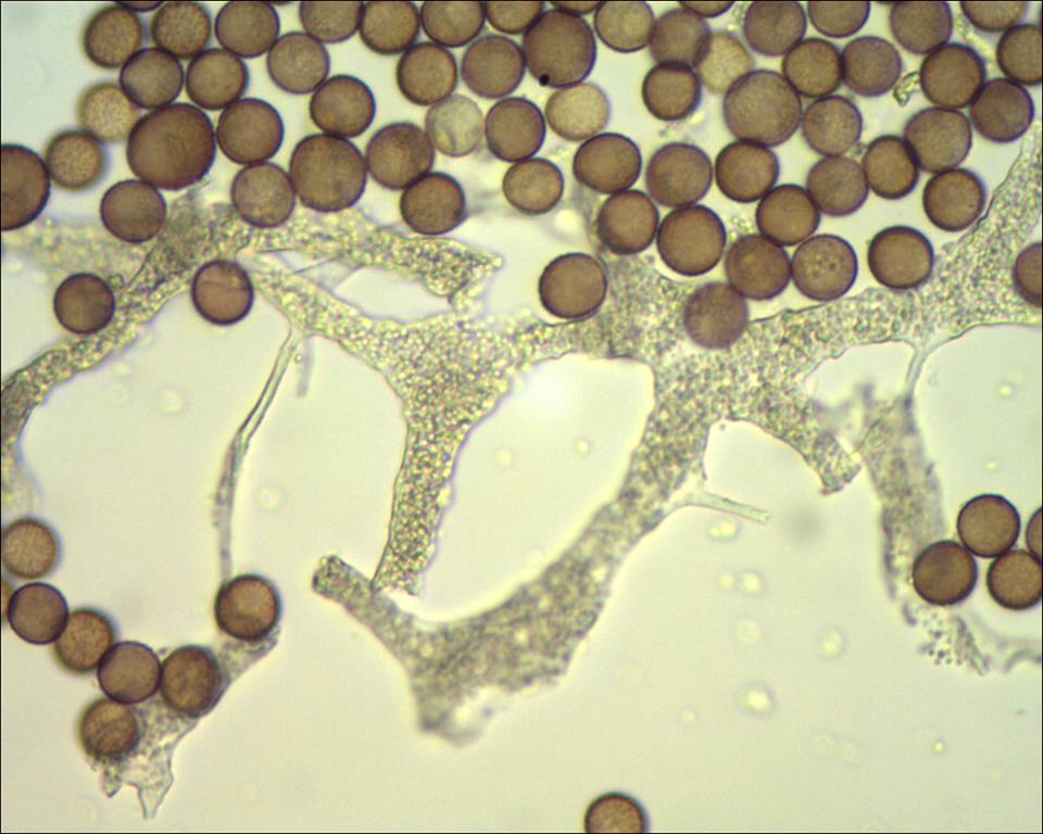 Badhamia foliicola??